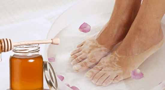 Honey Treat Dry and Cracked Heels at Home