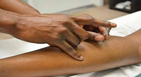 The Mysterious Origins And Early Stages And Early Stages Of Acupuncture
