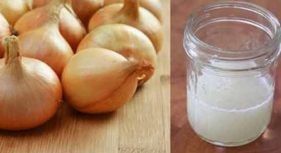 Extracted Onion Juice for Hair Loss