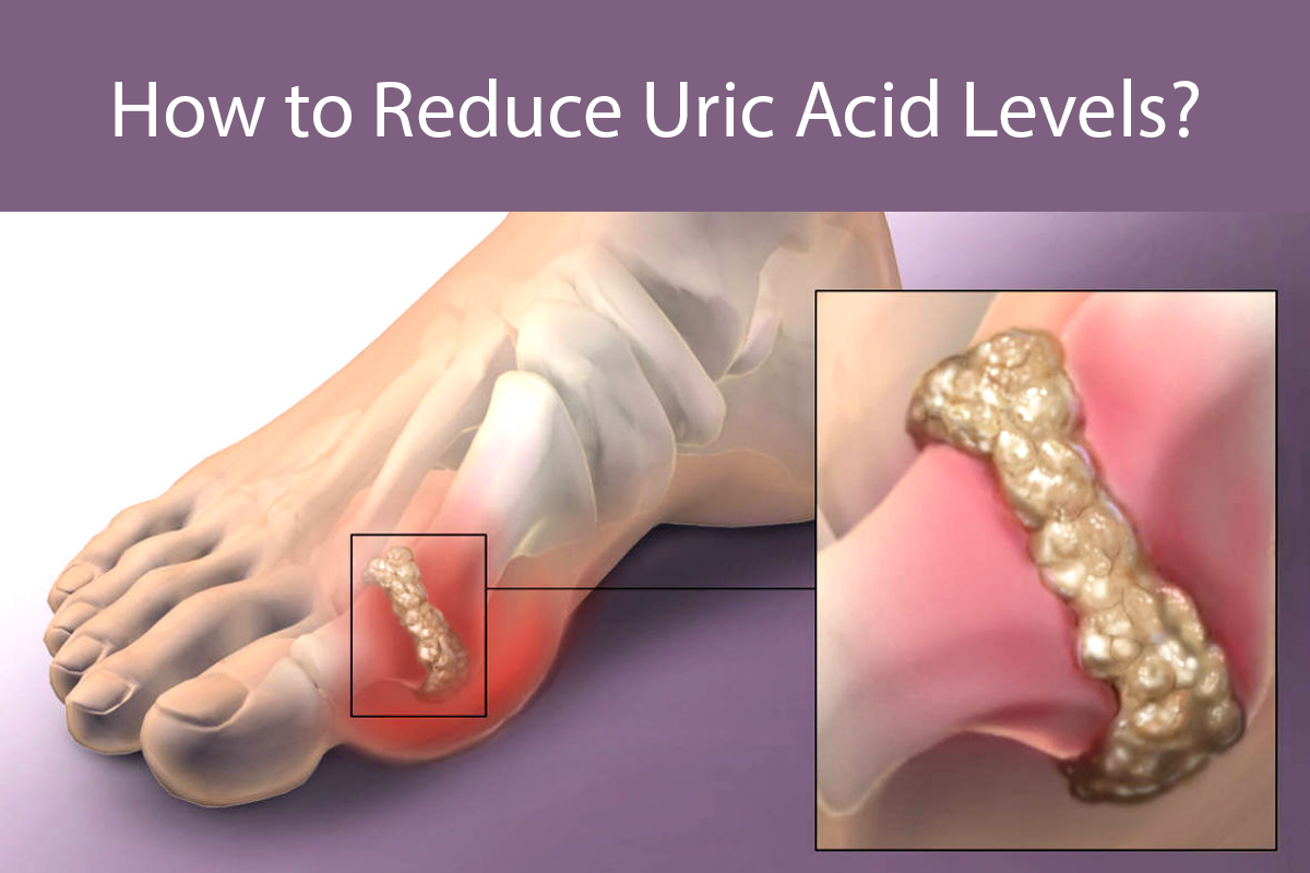 symptoms-of-high-uric-acid-3-common-signs-in-your-body