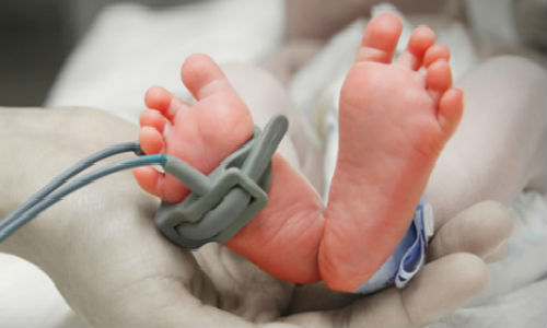 How To Care For A Premature Baby