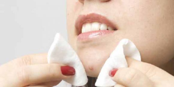 home remedies to cure boils