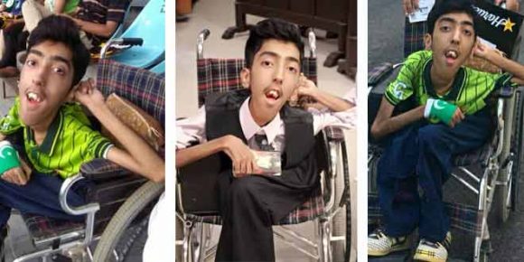 differently-abled kid ready to become social media star