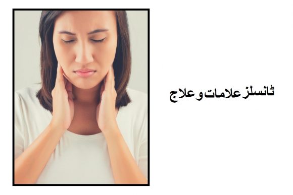 Symptoms and cure of tonsillitis
