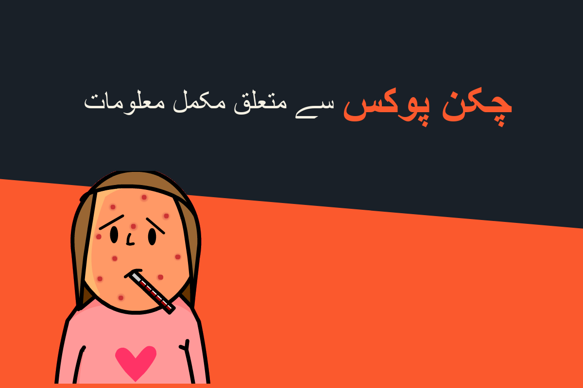 chickenpox complete info 29-11-17