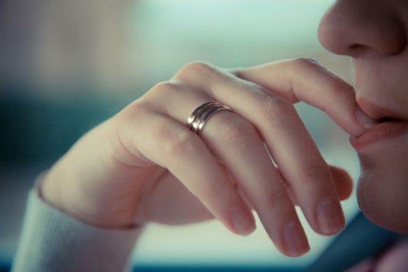 ring on a finger-skin allergy