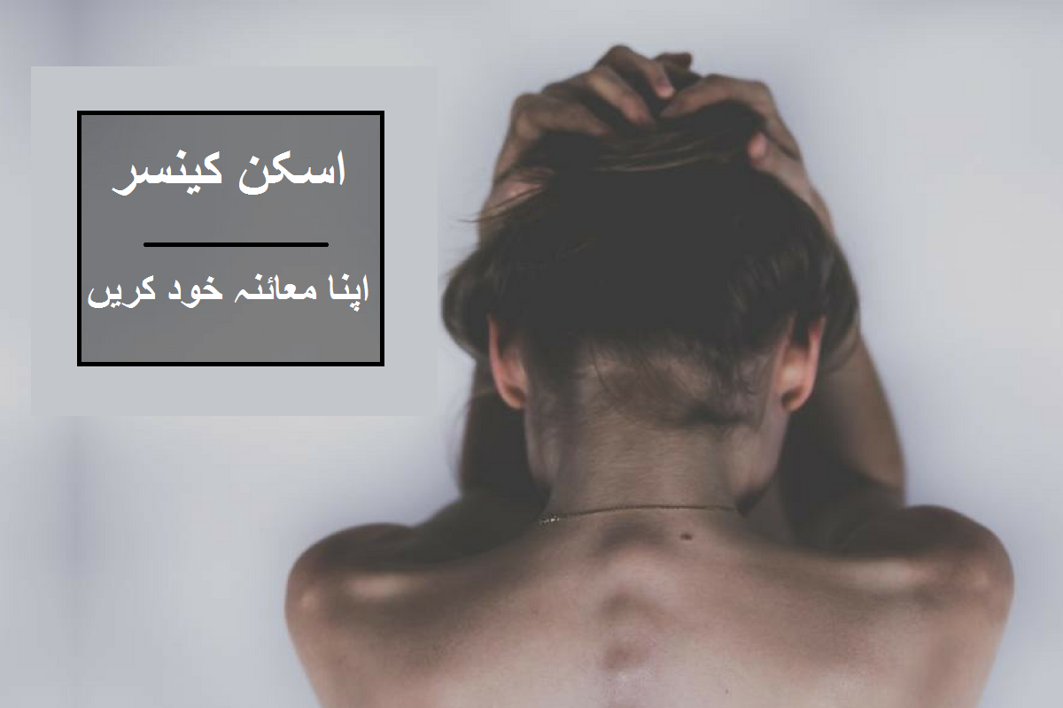 Skin Cancer: Self Examination