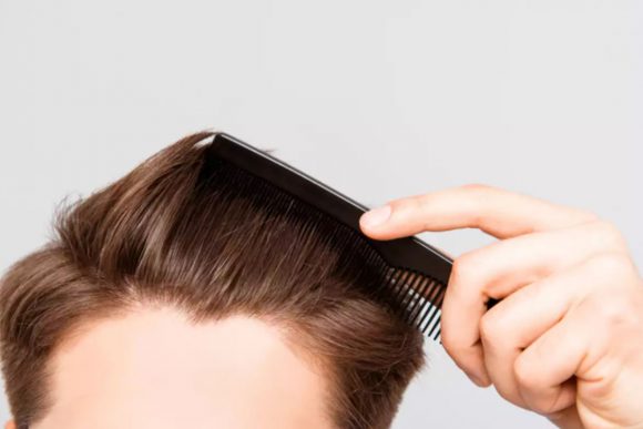 super-foods-for-baldness-and-hair-fall