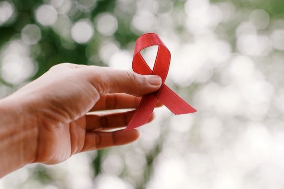 HIV aids 7-12-18