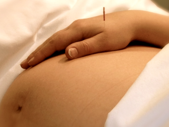 Ways Acupuncture Treatment Can Improve Your Health2