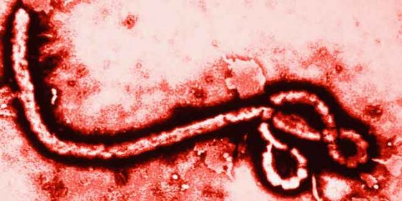 Antigen Test a Game-Changer In Fight Against Ebola