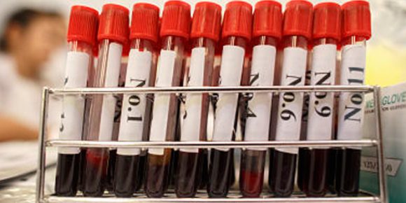 Blood samples being misplaced in Civil Hospital Karachi - HTV