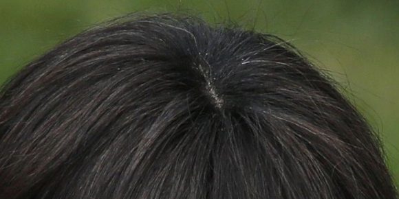 graying hair