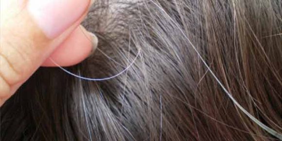 The gene IRF4 could play role in maintenance and survival of cells that make pigment and slow the process of hair turning grey. So, you get less grey hair.
