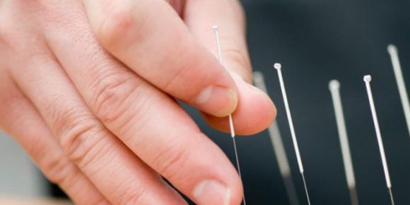 acupuncture decreases by hot flashes