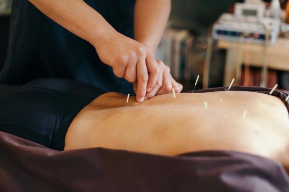 Can Acupuncture Help With Weight Loss Here’s The Truth