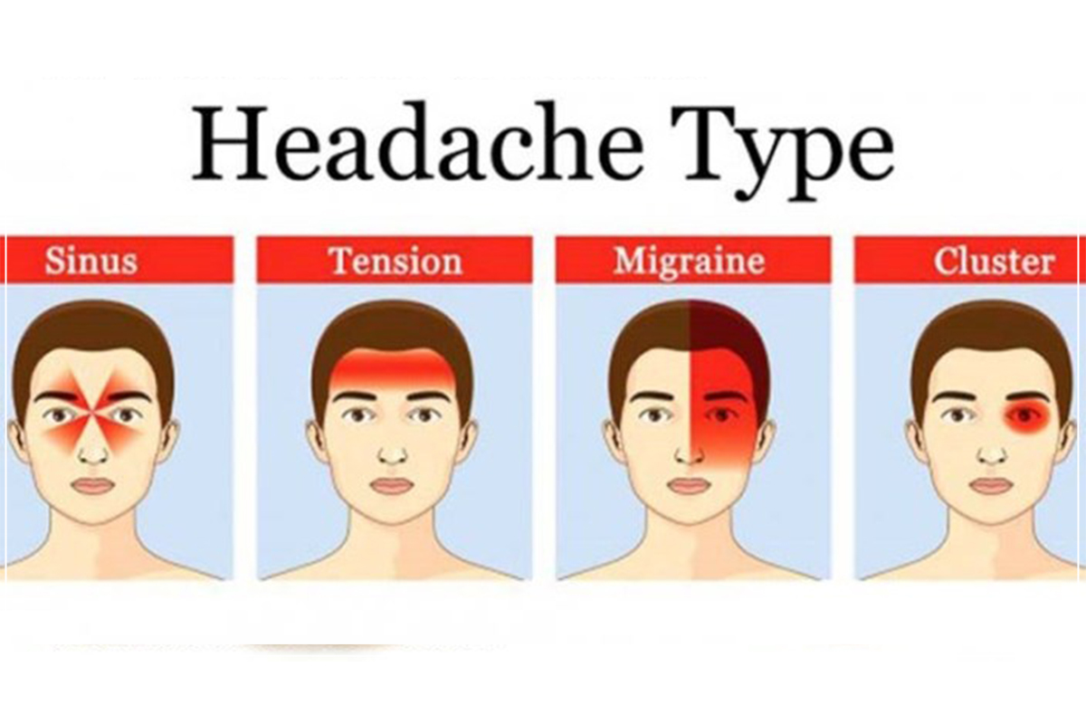 How To Know If You Have A Headache Or Migraine 