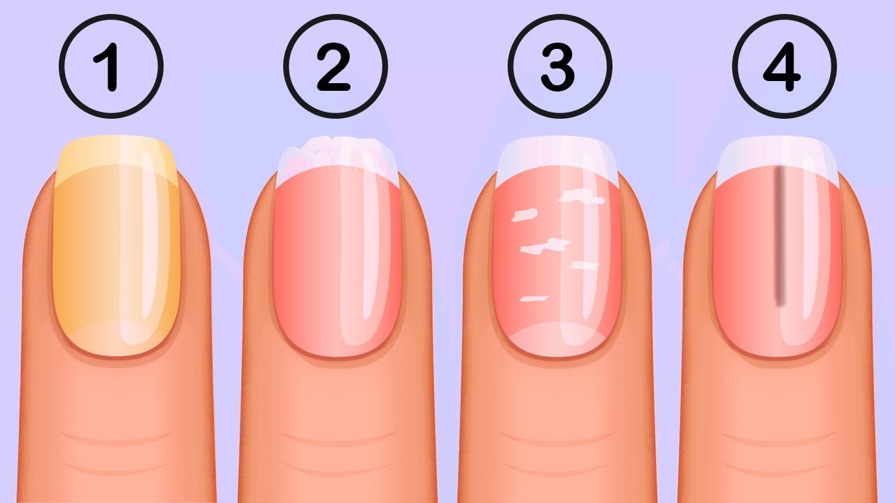 Nail Designs with Medical Symbols - wide 10